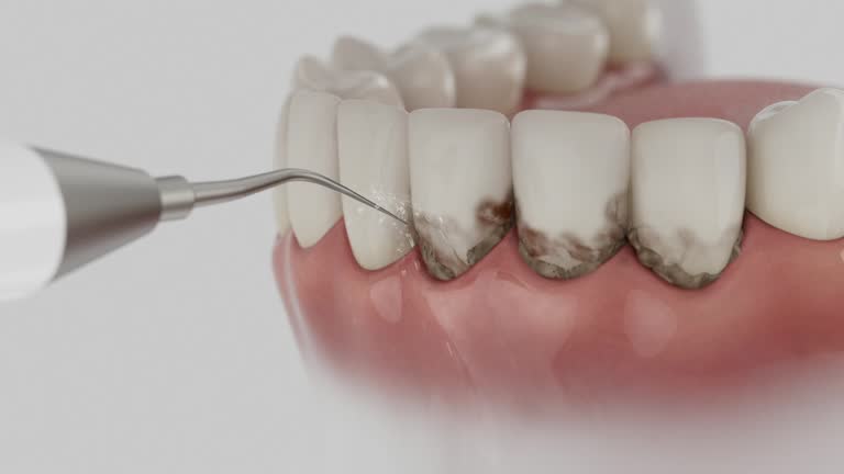 Trusted Invisalign Clear Aligners service in Gardendale, TX - Dentist Open Now